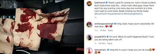 Kashmira Shah Suffers Major Road Accident, Shares Blood-Stained Napkin Photos and Expresses Gratitude
